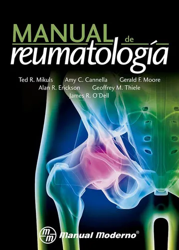 Portada de Manual de reumatología