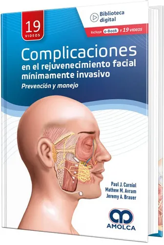 Portada de Complicaciones en el rejuvenecimiento facial mínimamente invasivo.Prevención y manejo