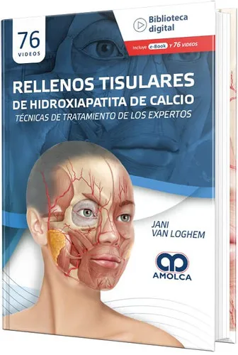 Portada de Rellenos Tisulares de Hidroxiapatita de Calcio. Técnicas de Tratamiento de los Expertos