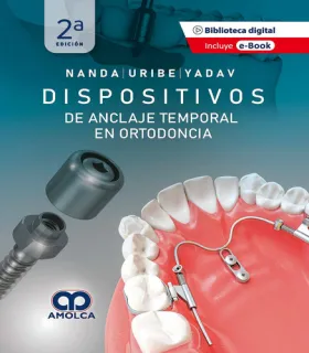 Portada de Dispositivos de anclaje temporal en Ortodoncia