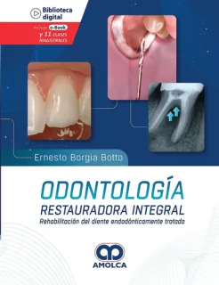 Portada de Odontología restauradora integral rehabilitación del diente endodónticamente tratado