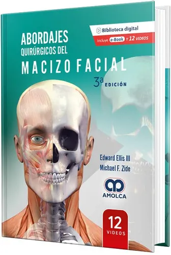 Portada de Abordajes Quirúrgicos del Macizo Facial
