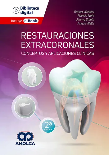 Portada de Restauraciones extracoronales conceptos y aplicaciones clínicas
