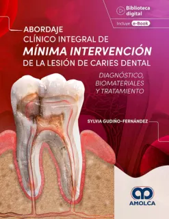 Portada de Abordaje clínico integral de mínima intervención de la lesión de caries dental diagnóstico, biomateriales y tratamiento