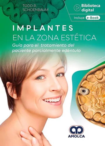 Portada de Implantes en la zona estética guía para el tratamiento del paciente parcialmente edéntulo