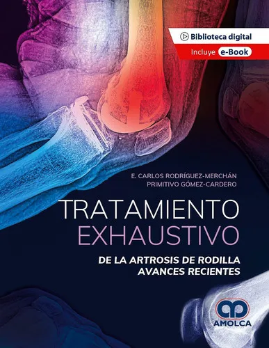 Portada de Tratamiento Exhaustivo de la Artrosis de Rodilla. Avances Recientes