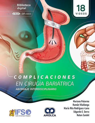 Portada de Complicaciones en Cirugía Bariátrica. Abordaje interdisciplinario