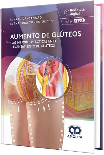 Portada de Aumento de Glúteos. Las Mejores Prácticas en el Levantamiento de Glúteos
