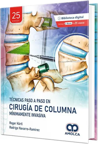 Portada de Técnicas Paso a Paso en Cirugía de Columna Mínimamente Invasiva