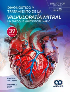 Portada de Diagnóstico y tratamiento de la valvulopatía mitral
