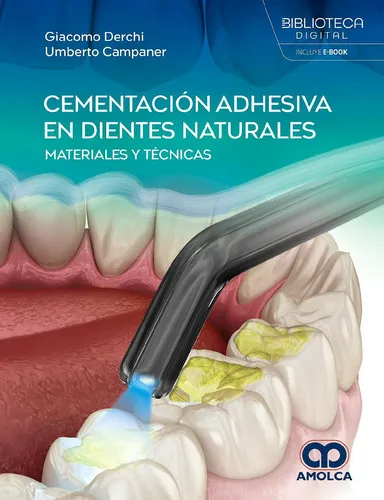 Portada de Cementación adhesiva en dientes naturales materiales y técnicas