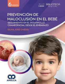Portada de Prevención de maloclusión en el bebé seguimiento en el desarrollo craneofacial desde el embarazo