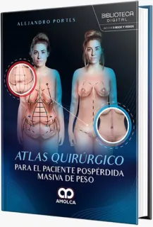 Portada de Atlas quirúrgico para el paciente pospérdida masiva de peso