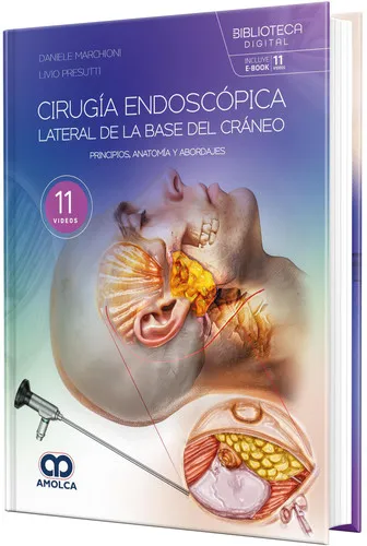 Portada de Cirugía endoscópica lateral de la base del cráneo. Principios, anatomía y abordajes