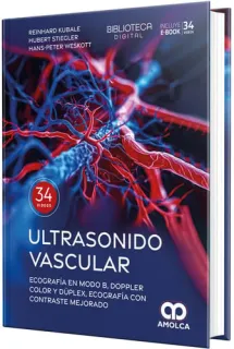 Portada de Ultrasonido vascular. Ecografía en Modo B, Doppler color y dúplex, ecografía con contraste mejorado