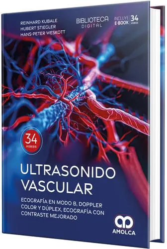 Portada de Ultrasonido vascular. Ecografía en Modo B, Doppler color y dúplex, ecografía con contraste mejorado