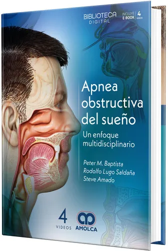 Portada de Apnea obstructiva del sueño Un enfoque multidisciplinario