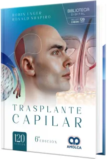 Portada de Trasplante capilar. 6.a edición