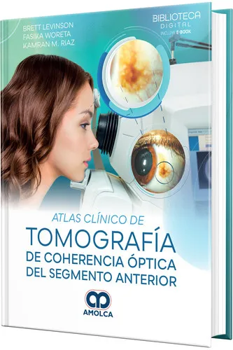 Portada de Atlas clínico de tomografía de coherencia óptica del segmento anterior 2 ed