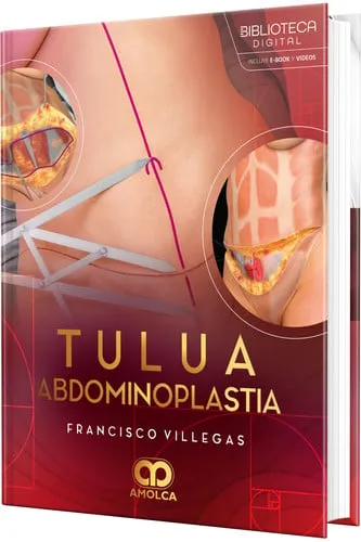 Portada de Tulua Abdominoplastia.