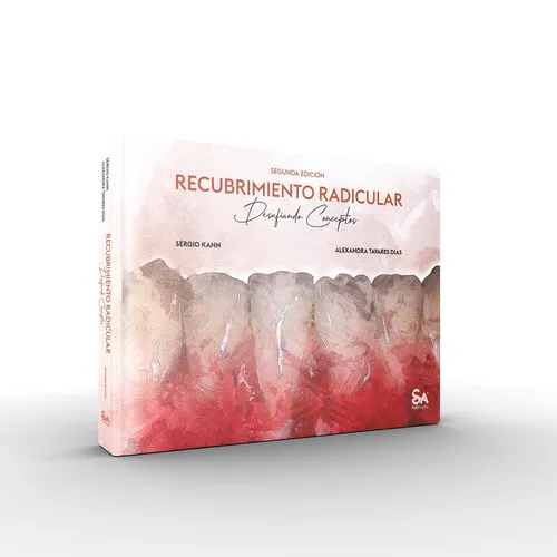 Portada de Recubrimiento Radicular - Desafiando Conceptos (Spanish Edition)