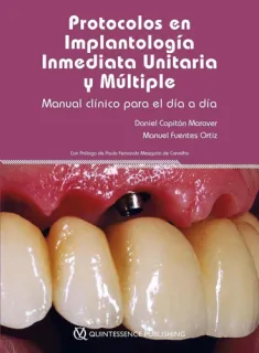 Portada de Protocolos en implantología inmediata unitaria y múltiple