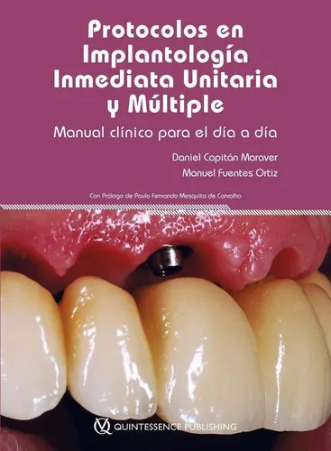 Portada de Protocolos en implantología inmediata unitaria y múltiple