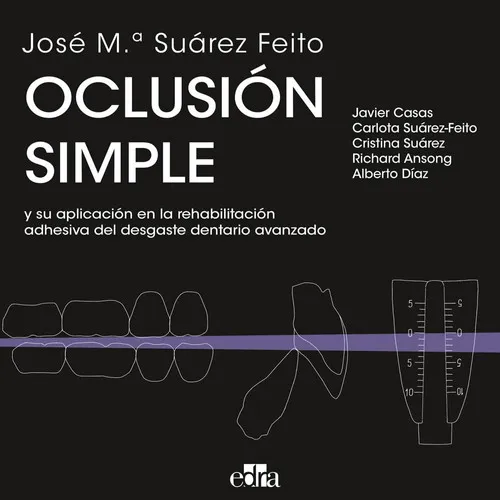 Portada de Oclusión simple y su aplicación en la rehabilitación adhesiva del desgaste dentario avanzado
