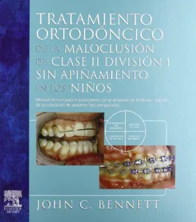 Portada de Tratamiento ortodóncico de la maloclusión de clase II división 1 sin apiñamiento en los niños