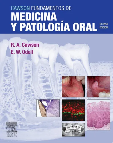Portada de Cawson fundamentos de medicina y patología oral