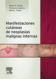Portada de Manifestaciones cutáneas de neoplasias malignas internas