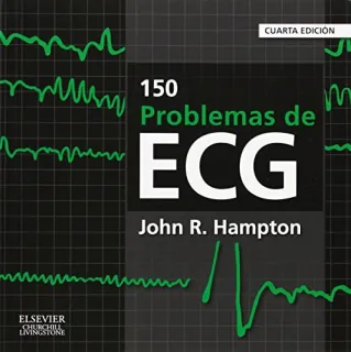 Portada de 150 problemas de ECG