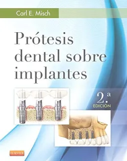 Portada de Prótesis dental sobre implantes