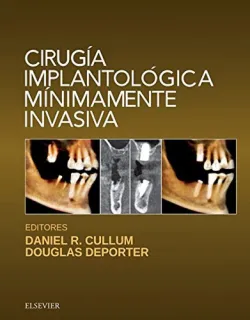 Portada de Cirugía implantológica mínimamente invasiva