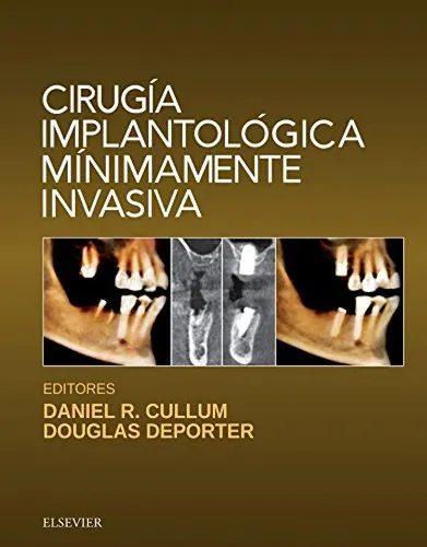 Portada de Cirugía implantológica mínimamente invasiva