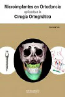 Portada de Microimplantes en ortodoncia aplicada a la cirugía ortognática