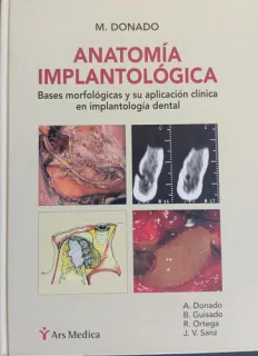 Portada de Anatomía implantológica: bases morfológicas y su aplicación clínica en implantología dental