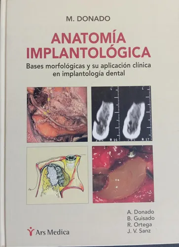 Portada de Anatomía implantológica: bases morfológicas y su aplicación clínica en implantología dental