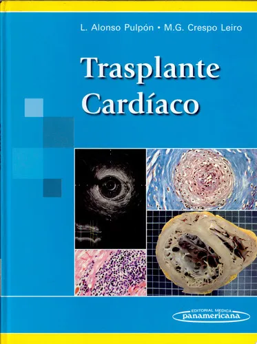Portada de Trasplante cardíaco