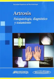 Portada de Artrosis: fisiopatología, diagnóstico y tratamiento
