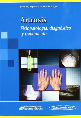 Portada de Artrosis: fisiopatología, diagnóstico y tratamiento