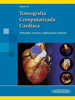Portada de Tomografía computarizada cardíaca: principios, técnica y aplicaciones clínicas