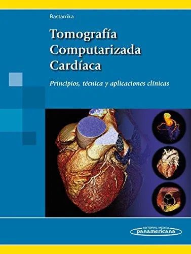 Portada de Tomografía computarizada cardíaca: principios, técnica y aplicaciones clínicas