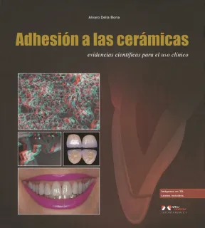 Portada de ADHESIÓN A LAS CERÁMICAS: EVIDENCIAS CIENTIFICAS PARA EL USO CLÍNICO EN ODONTOLOGÍA
