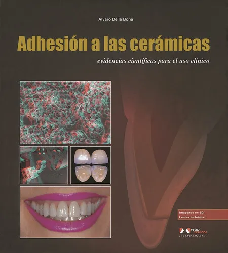 Portada de ADHESIÓN A LAS CERÁMICAS: EVIDENCIAS CIENTIFICAS PARA EL USO CLÍNICO EN ODONTOLOGÍA