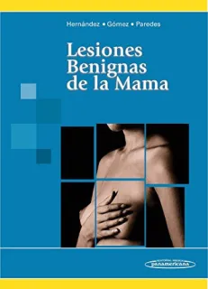 Portada de Lesiones benignas de la mama