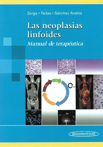 Portada de Las neoplasias linfoides: manual de terapéutica