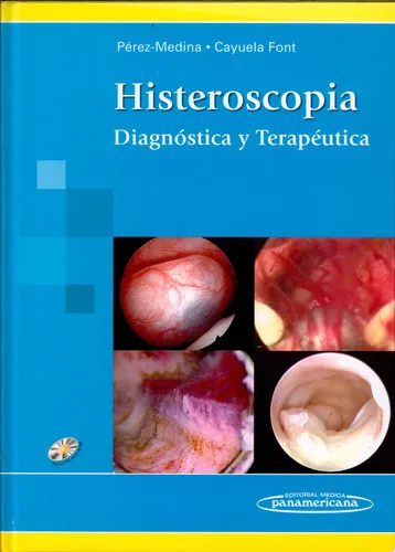 Portada de Histeroscopia diagnóstica y terapéutica