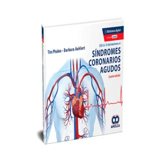 Portada de ECG de 12 Derivaciones en Síndromes Coronarios Agudos (Incluye E-Book)