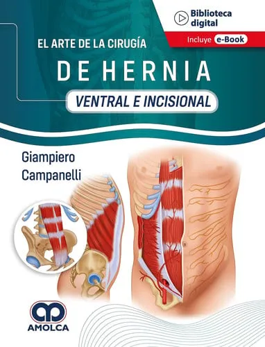 Portada de El Arte de la Cirugía de Hernia, Ventral e Incisional (Spanish Edition)